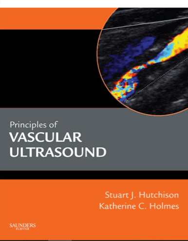 picture of vascular ultrasound image