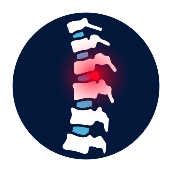 picture of herniated disc