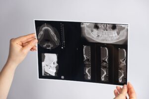 cone-beam CT image