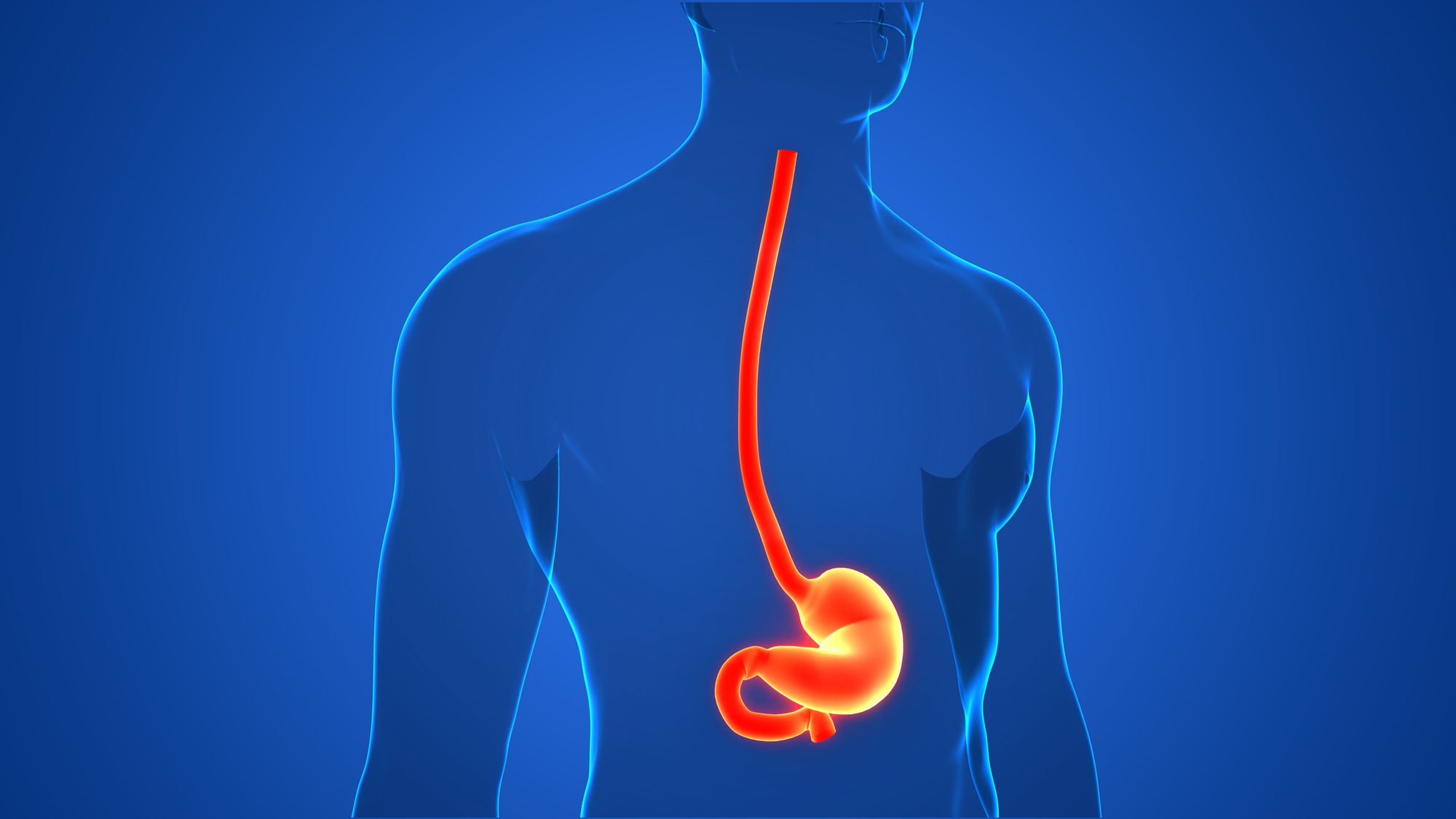 Diseases of the Upper GI Tract Get Your CEU