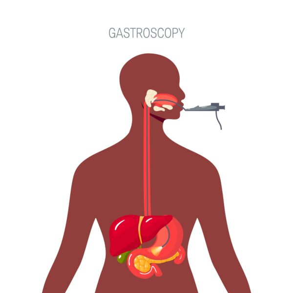 women getting endoscopic examination