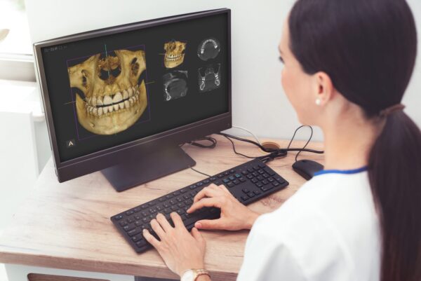 Evaluation of Oral and Maxillary Abnormalities