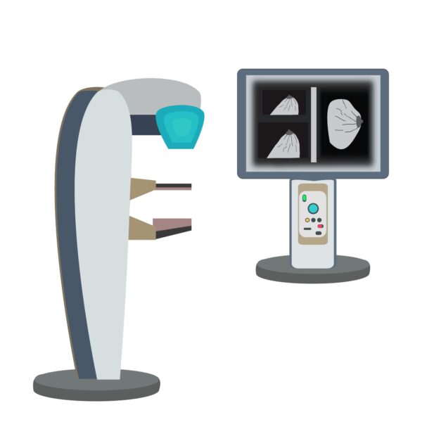 Evaluating Breast Discharge