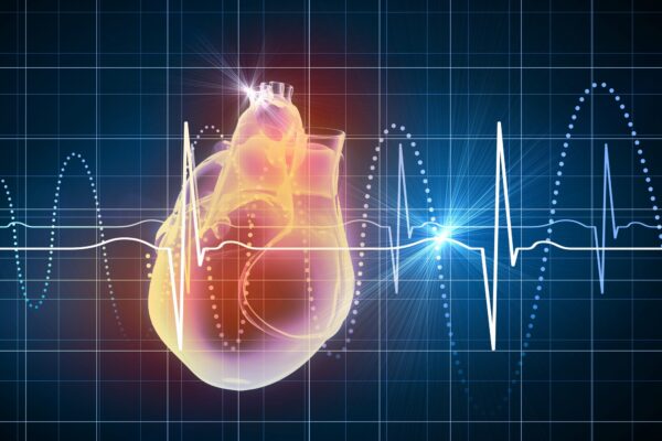 History of Coronary Angiography