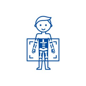 x-ray of chest