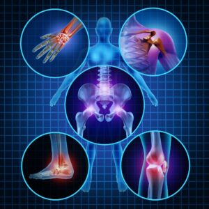 picture of body joints