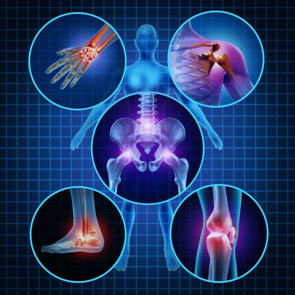 picture of body joints