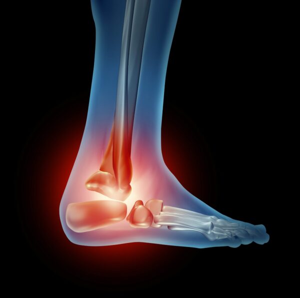 MRI of the Ankle and Foot