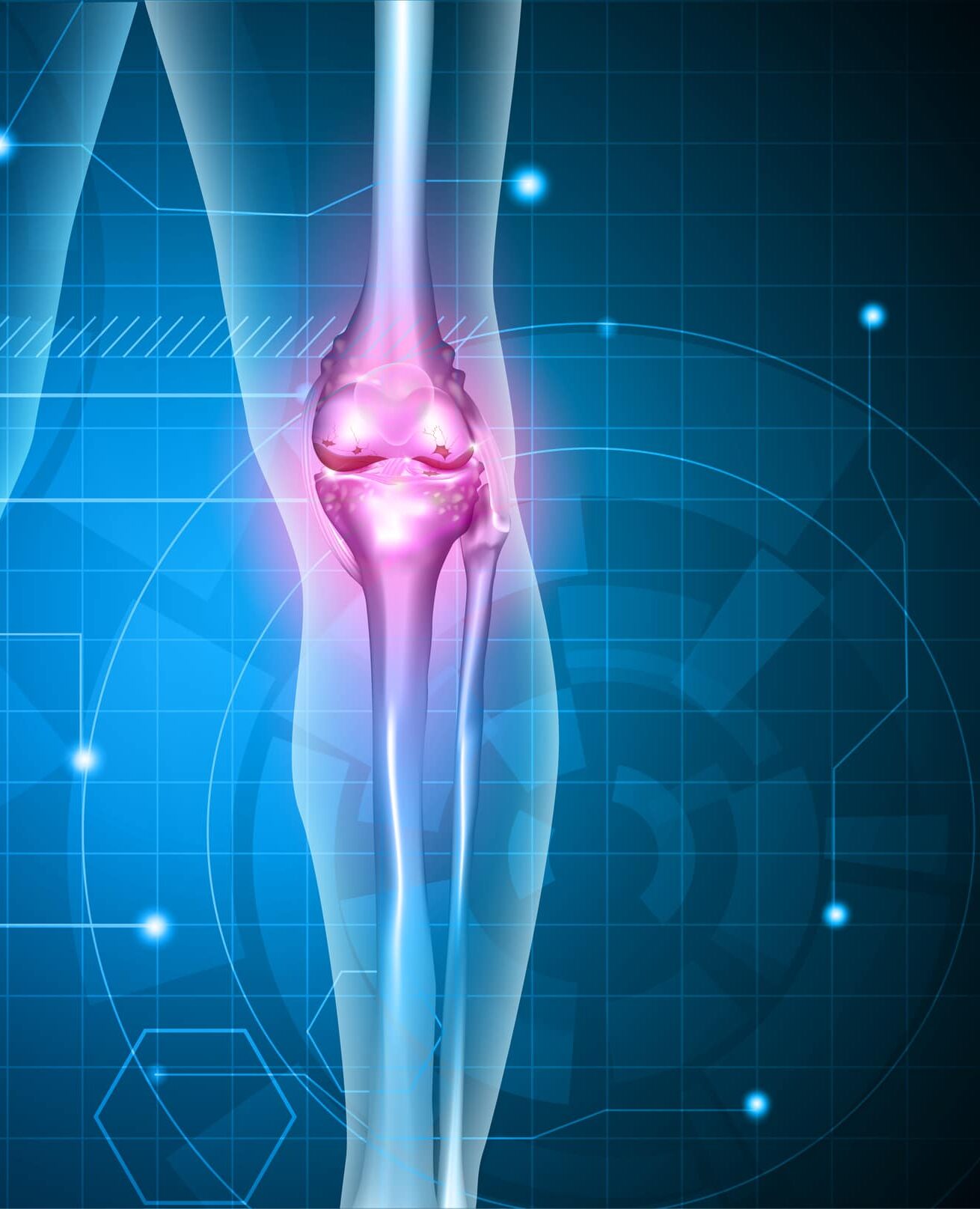 MRI of the Knee - 1.0 Category A Credit, Accepted for ARRT® and ARMRIT