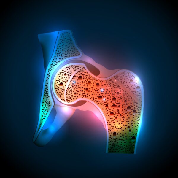 Post-Operative Management of Hip Fractures