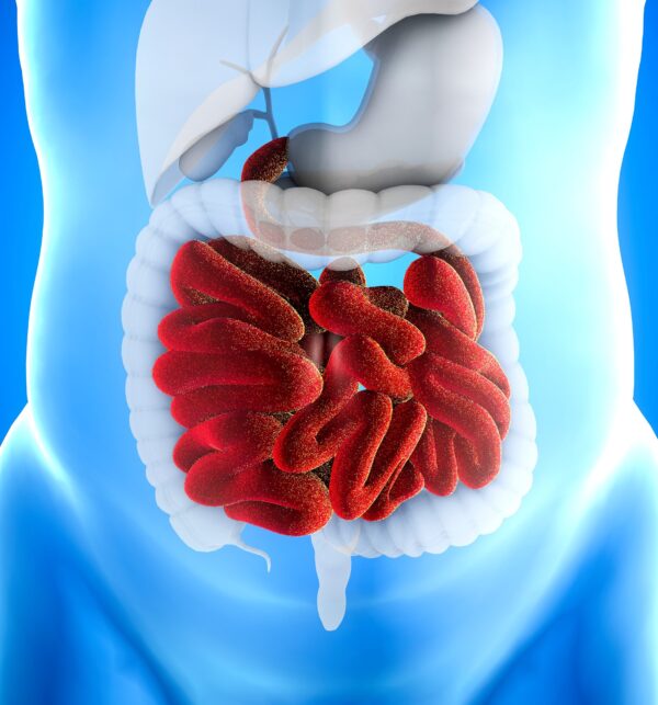color picture of the loops of the small bowel