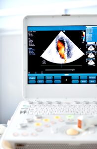 Ultrasound machine