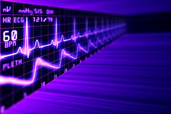 heart rate with ECG