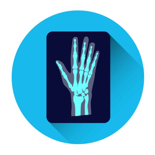 Wrist and Hand Imaging