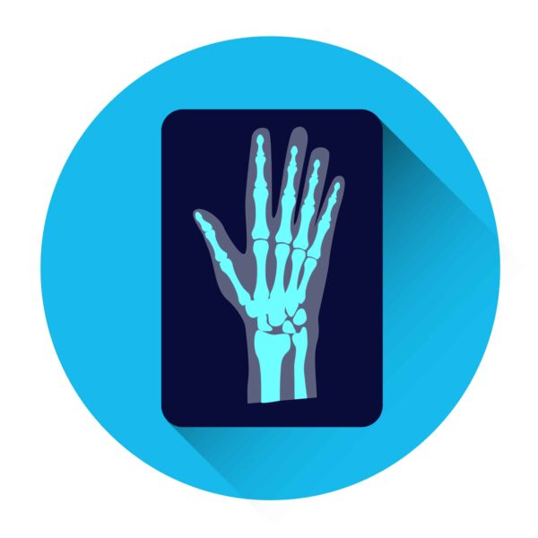 hand x-ray