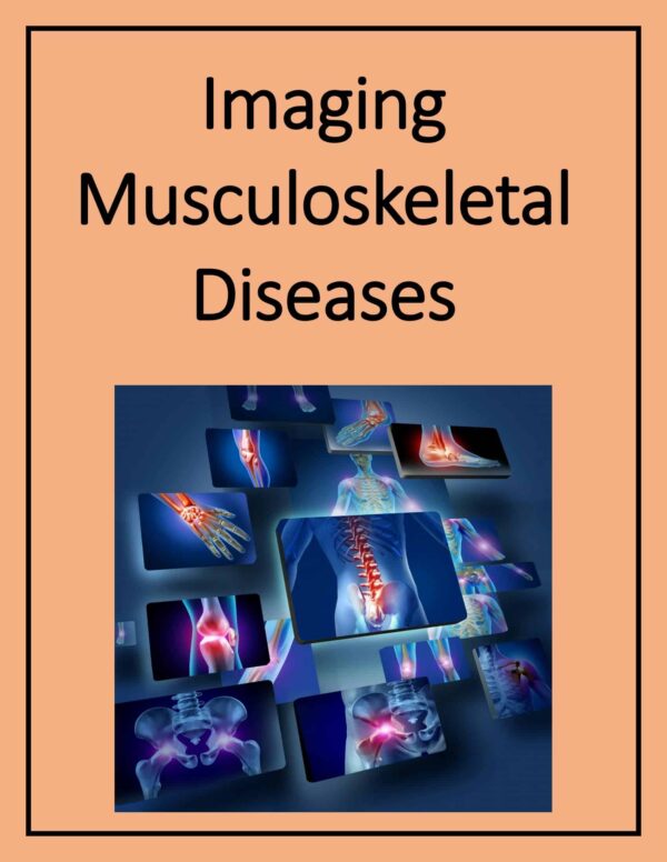 Imaging Musculoskeletal Diseases