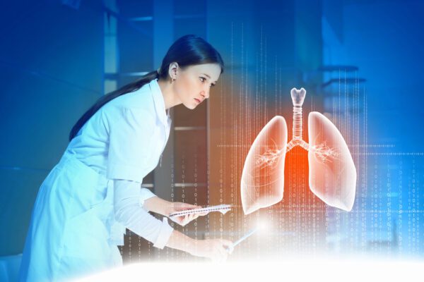 Evidence for Lung Cancer Screening