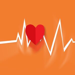 cardiac ECG rhythm strip