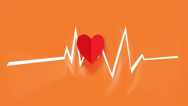 cardiac ECG rhythm strip