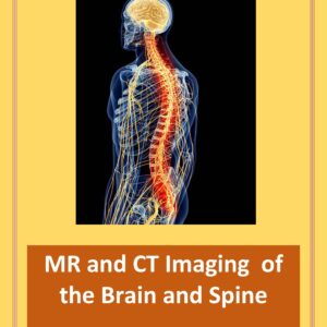 picture of human brain and spine