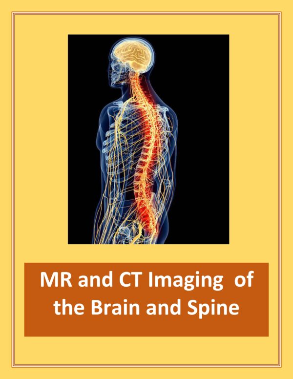 picture of human brain and spine