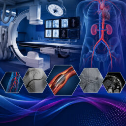 picture of interventional procedure room
